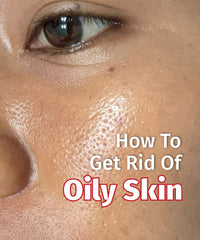 How To Get Rid Of Oily Skin & Prevent Excess Oil
