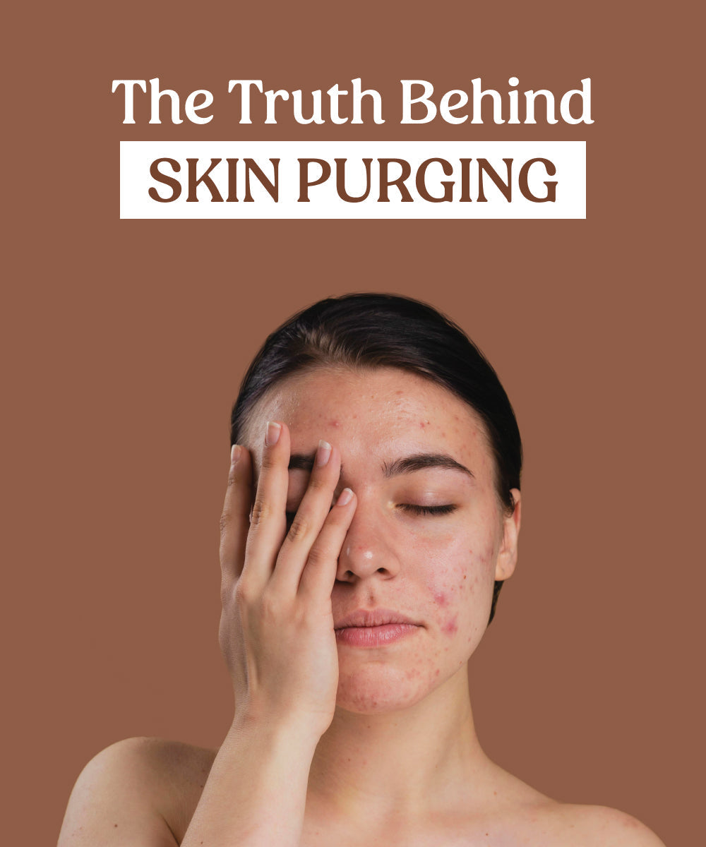 Purging Photo The Truth About Skin Purging And What You Should Know