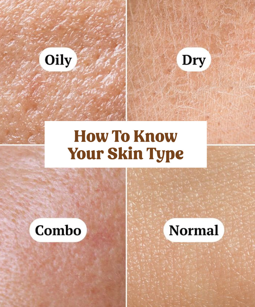 how to know your skin type