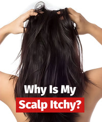 Why Is My Scalp Itchy, And How To Treat It Naturally?