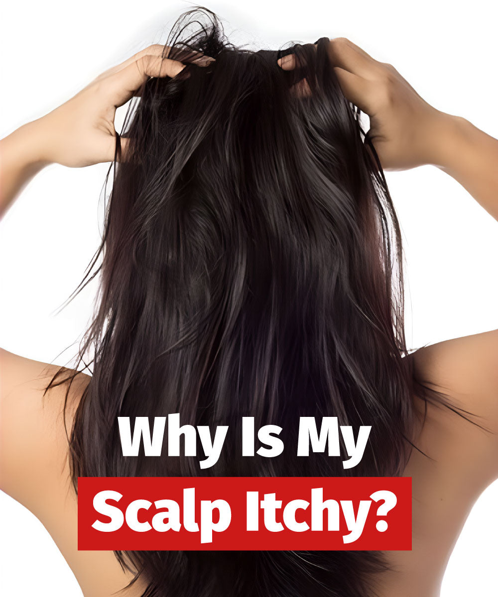 why is my scalp itchy?