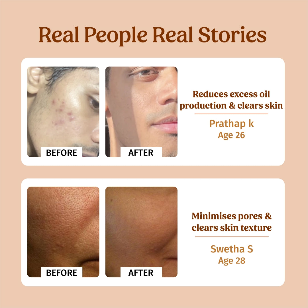 Milk Face Toner