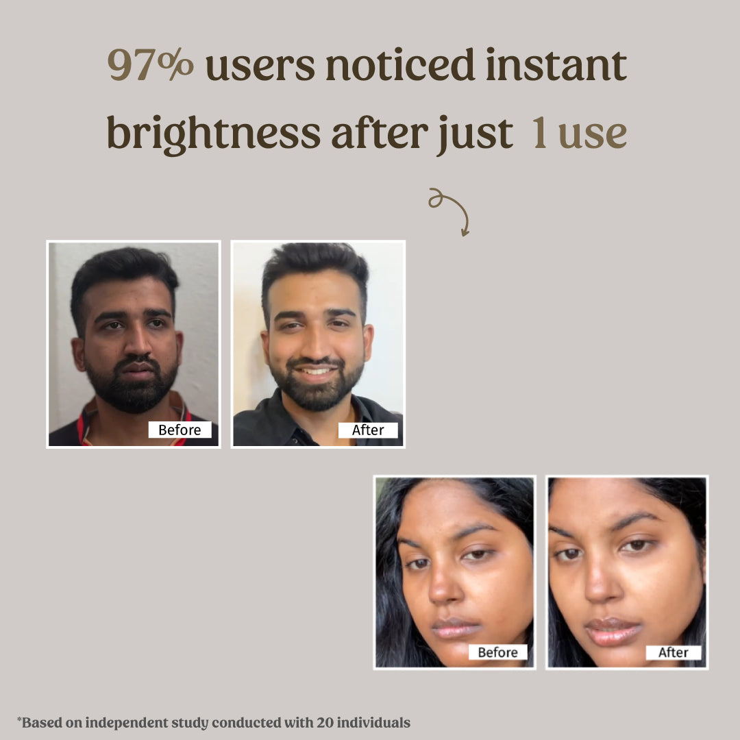 before and after using milk mud mask - Vilvah