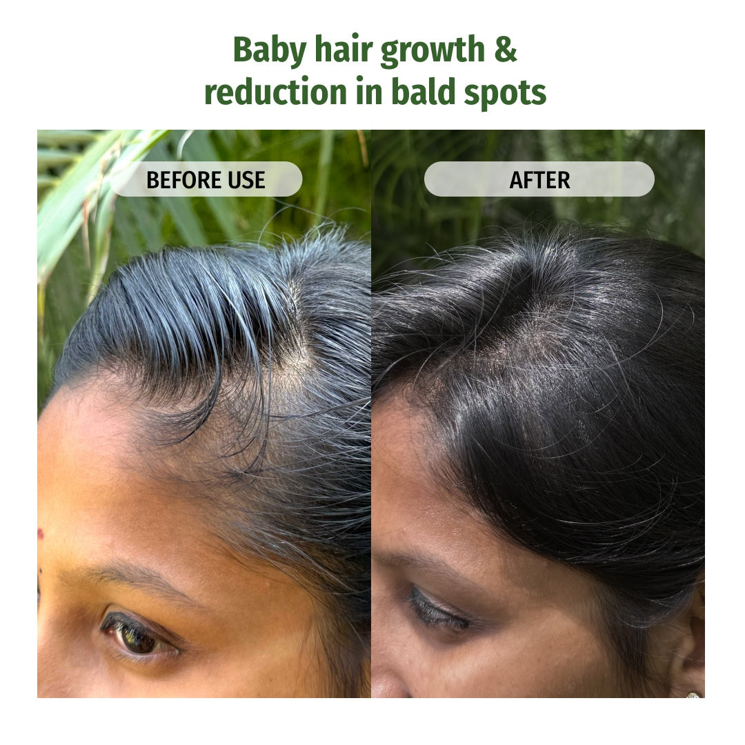 Hairfall Control Combo