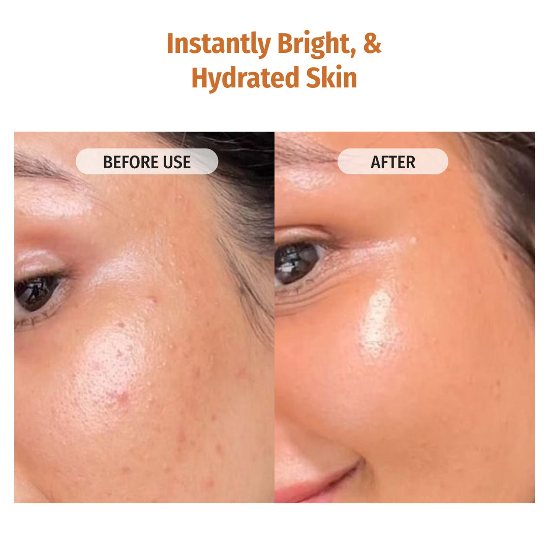 Vilvah Face Lift Combo Instantly Bright & Hydrated Skin