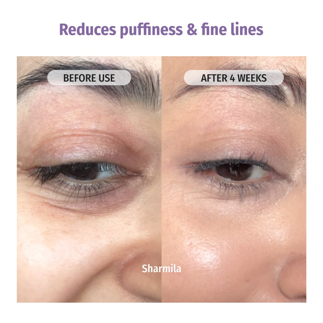 Vilvah Night Repair Combo reduces Puffiness & Fine Lines