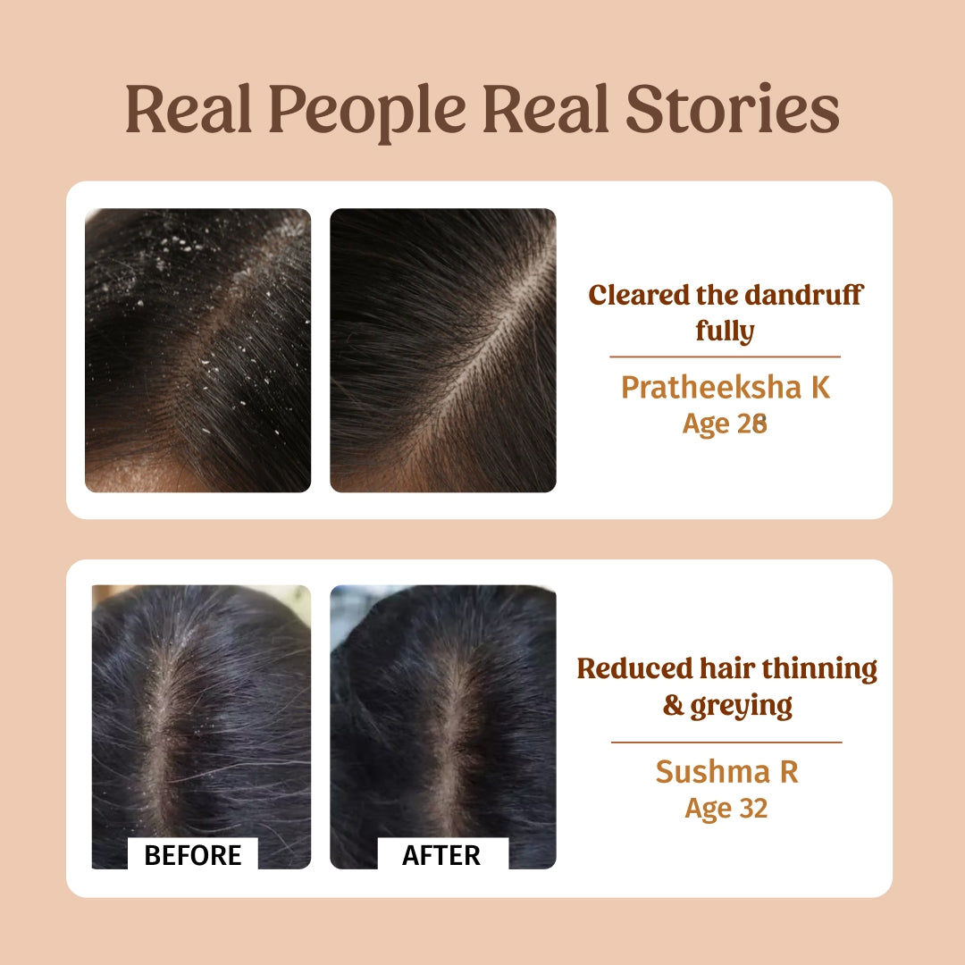 Herbal Shampoo (Dandruff Control) 250ml