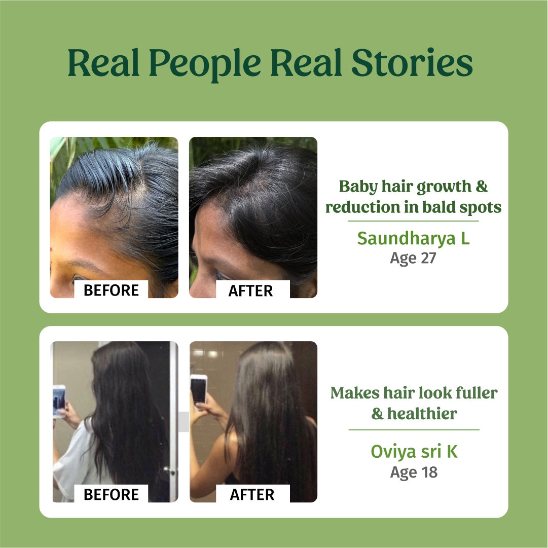 Before and After using Vilvah Hair Strengthening Combo