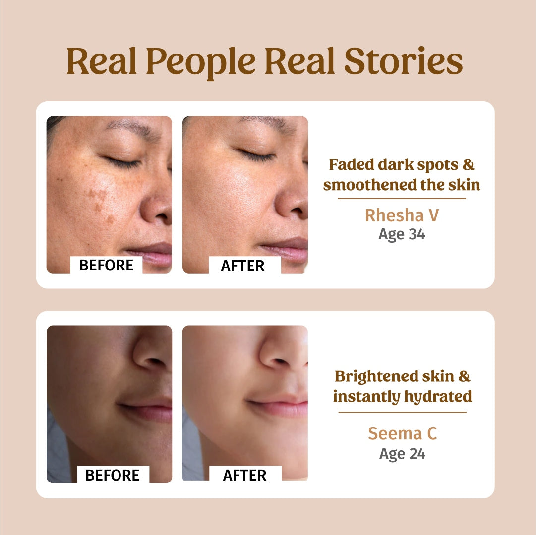 before and after using vilvah ultra moisturising cream