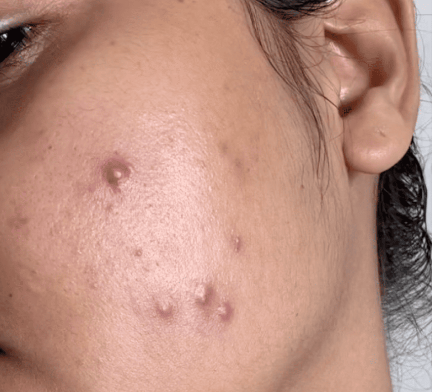 before using vilvah milk drop serum