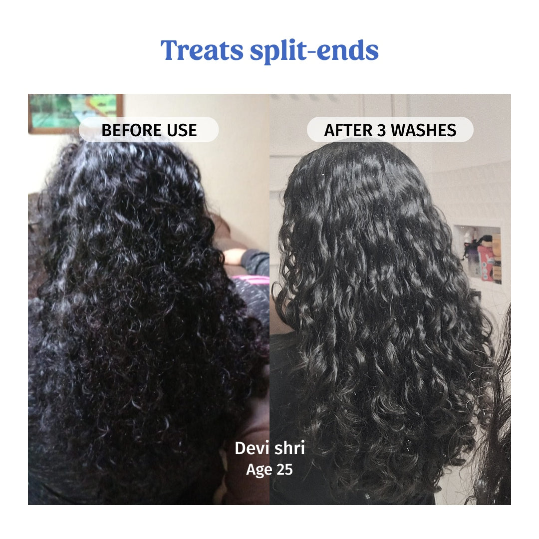 vilvah bestseller hair combo treats split ends