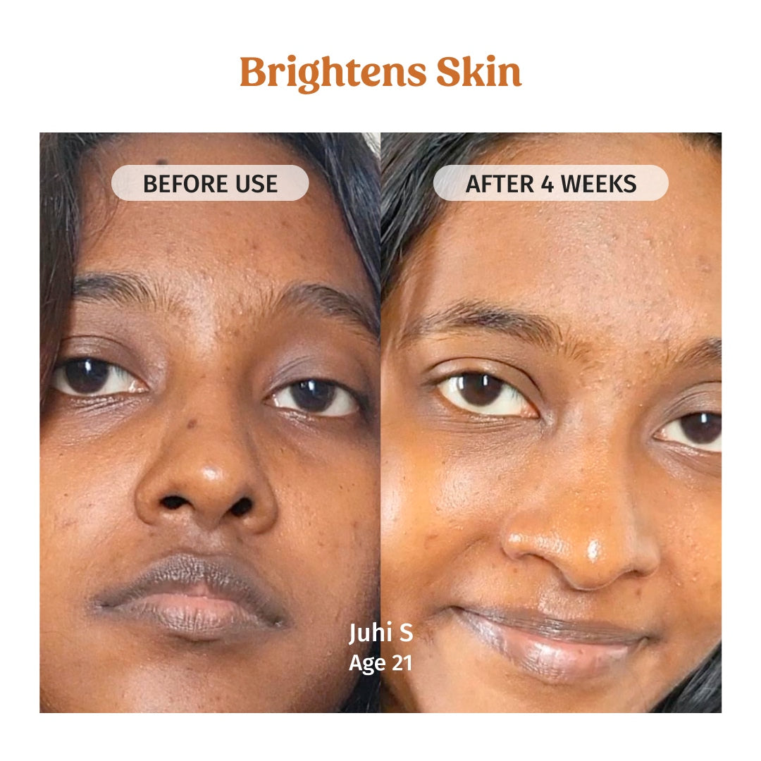 Face Brightening Combo