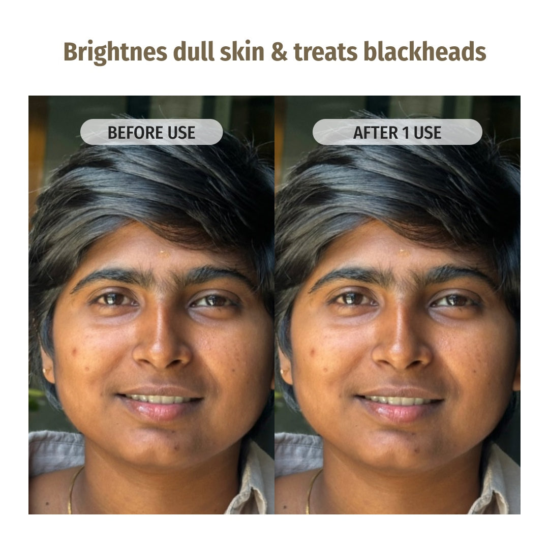 Vilvah Better Ageing Serum brightens dull skin and treats blackheads