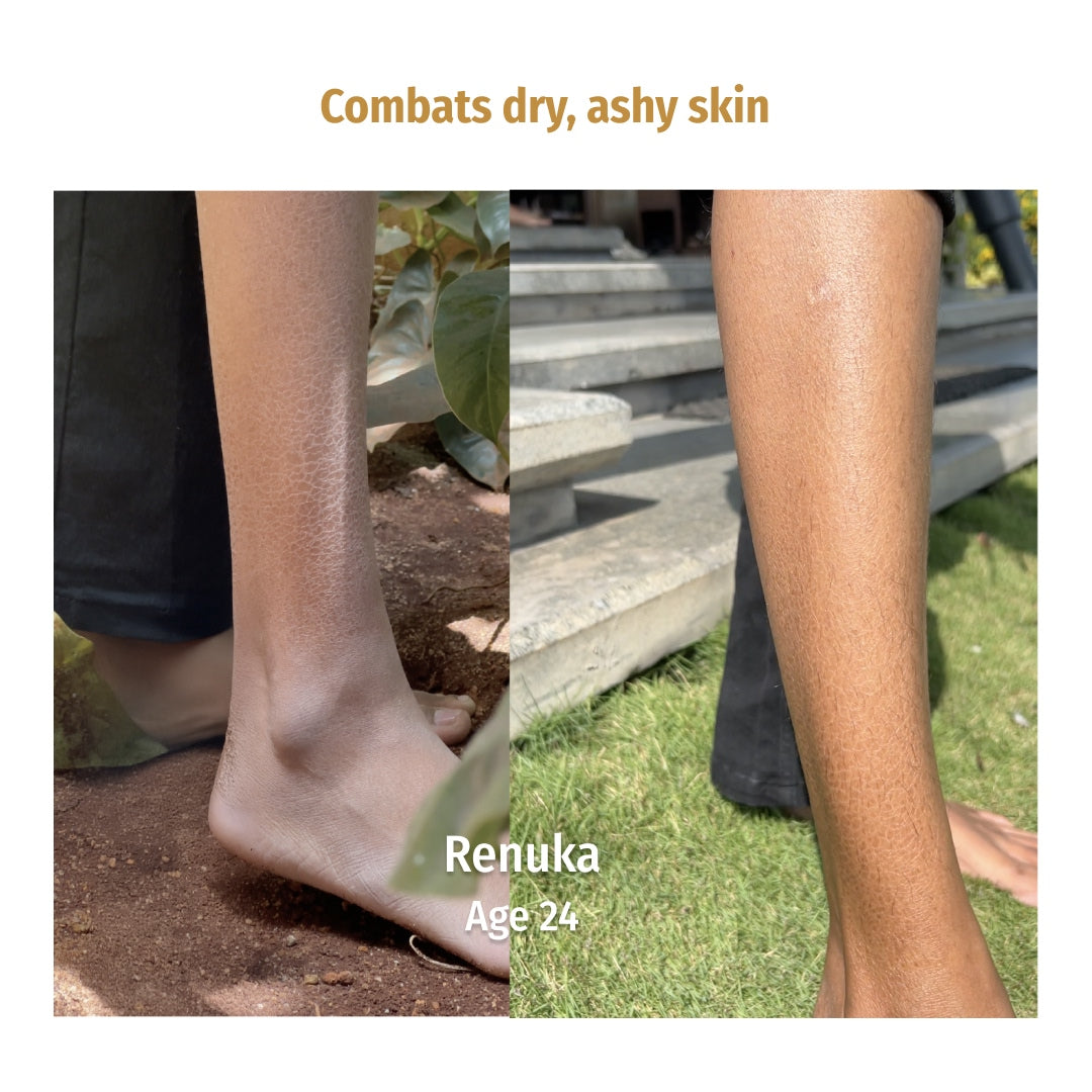 vilvah milk body lotion combats dry, ashy skin
