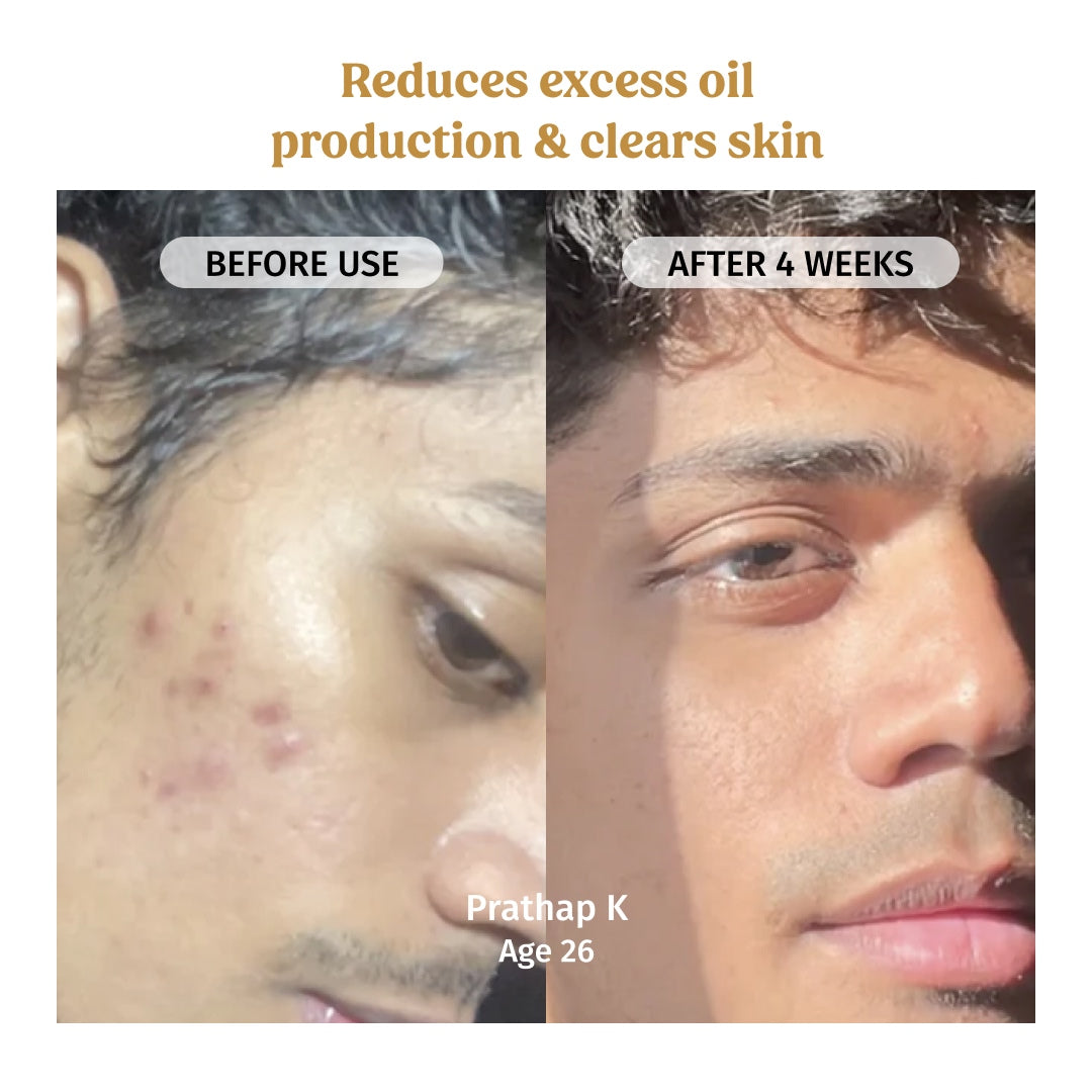 Before and After using Vilvah Skin Glow Combo