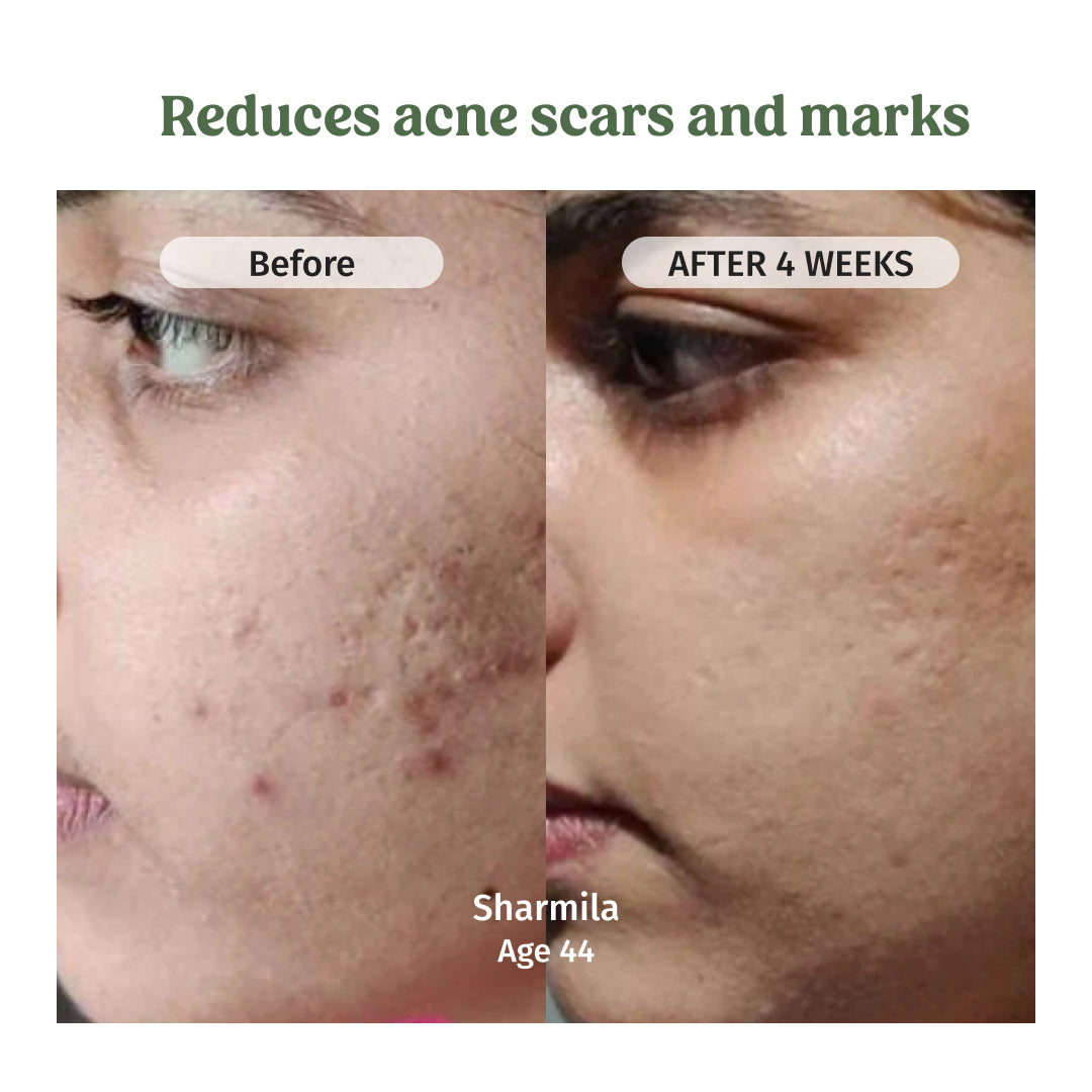 Clear Skin Combo
