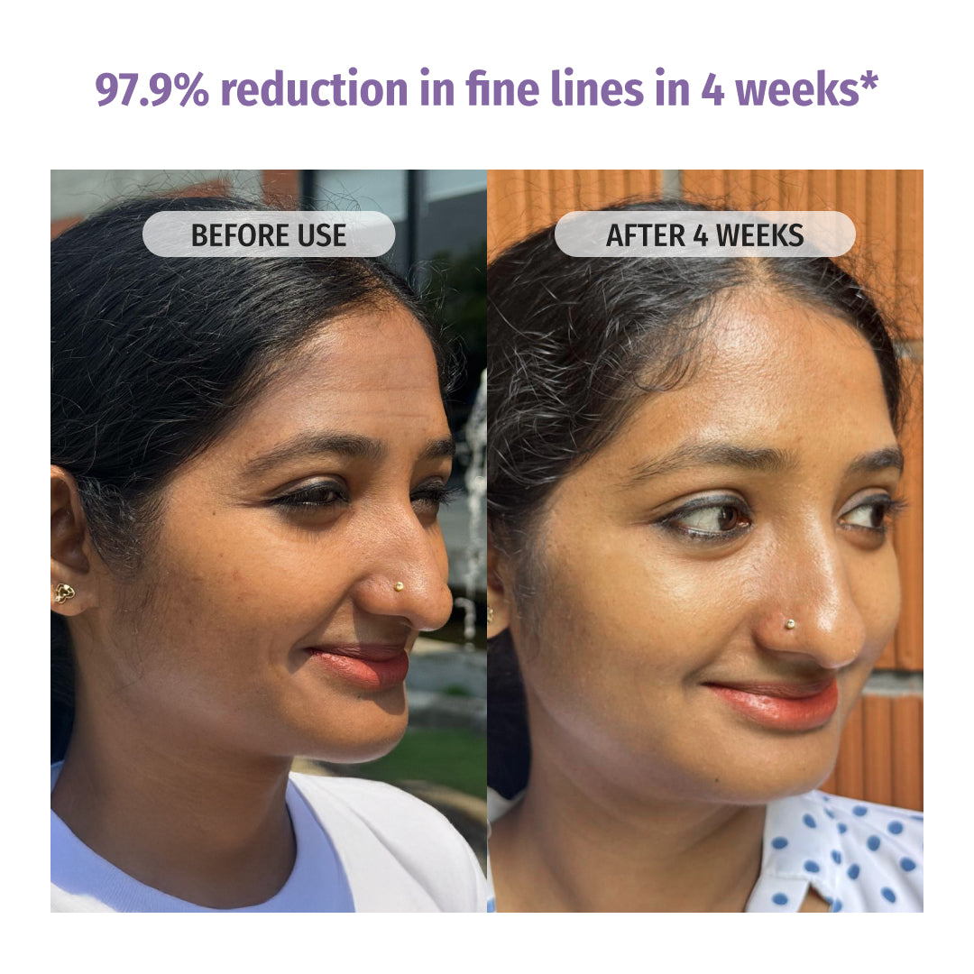 Vilvah Night Repair Combo reduces Fine Lines