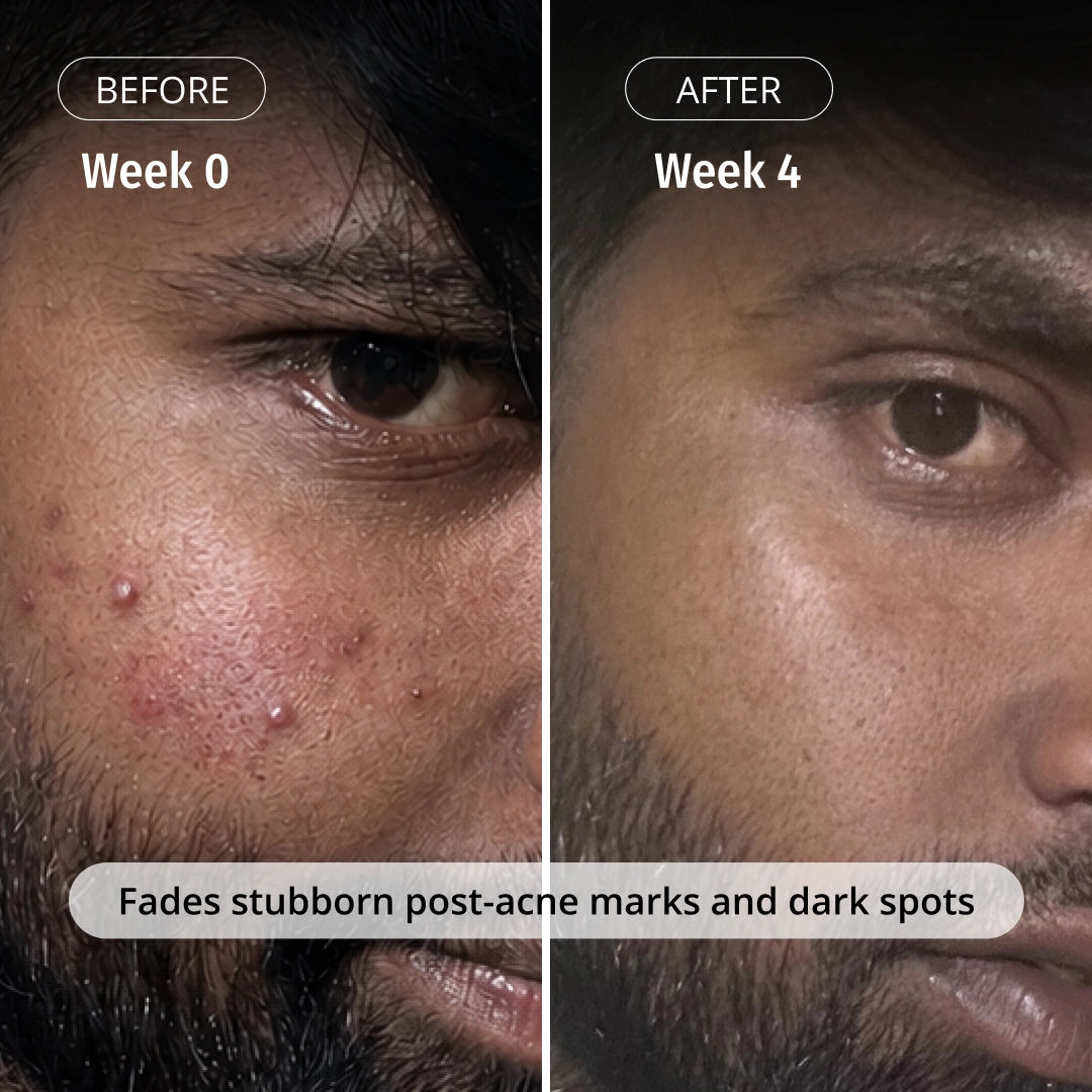 Milk Drops Brightening Serum
