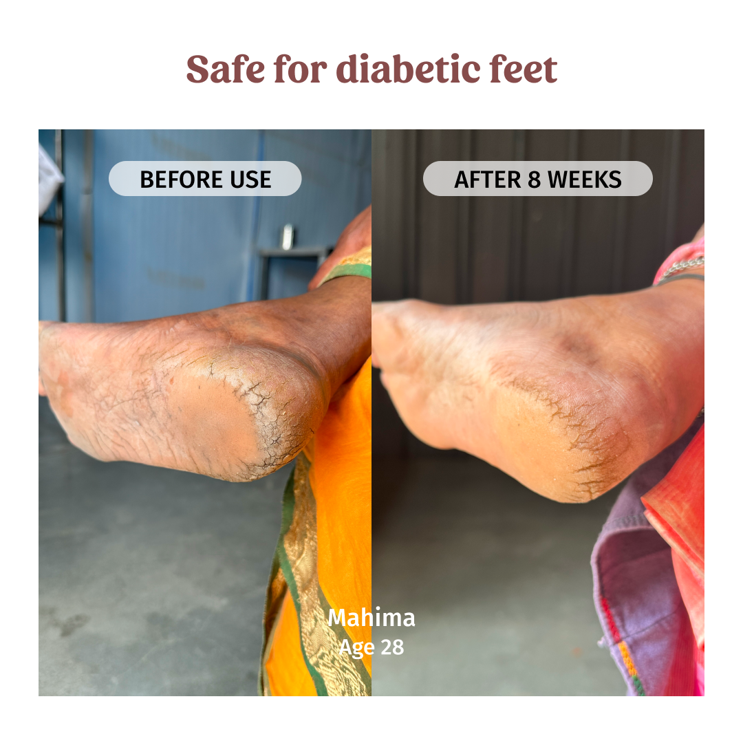 Foot Cream