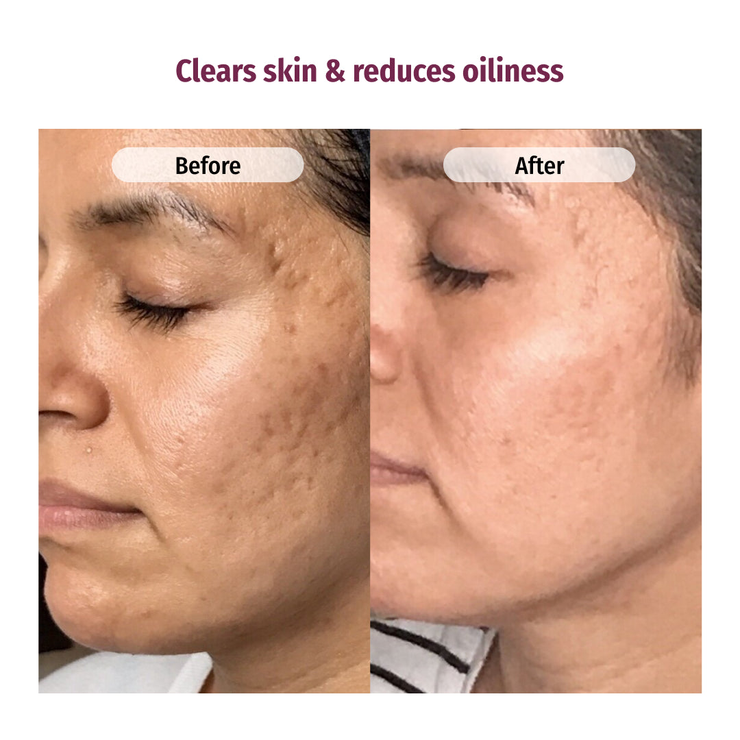 vilvah rose water facial toner clears skin and reduces oiliness