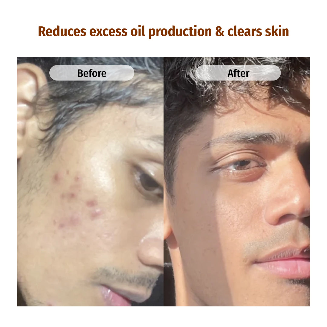 vilvah milk face toner reduces excess oil production and clears skin