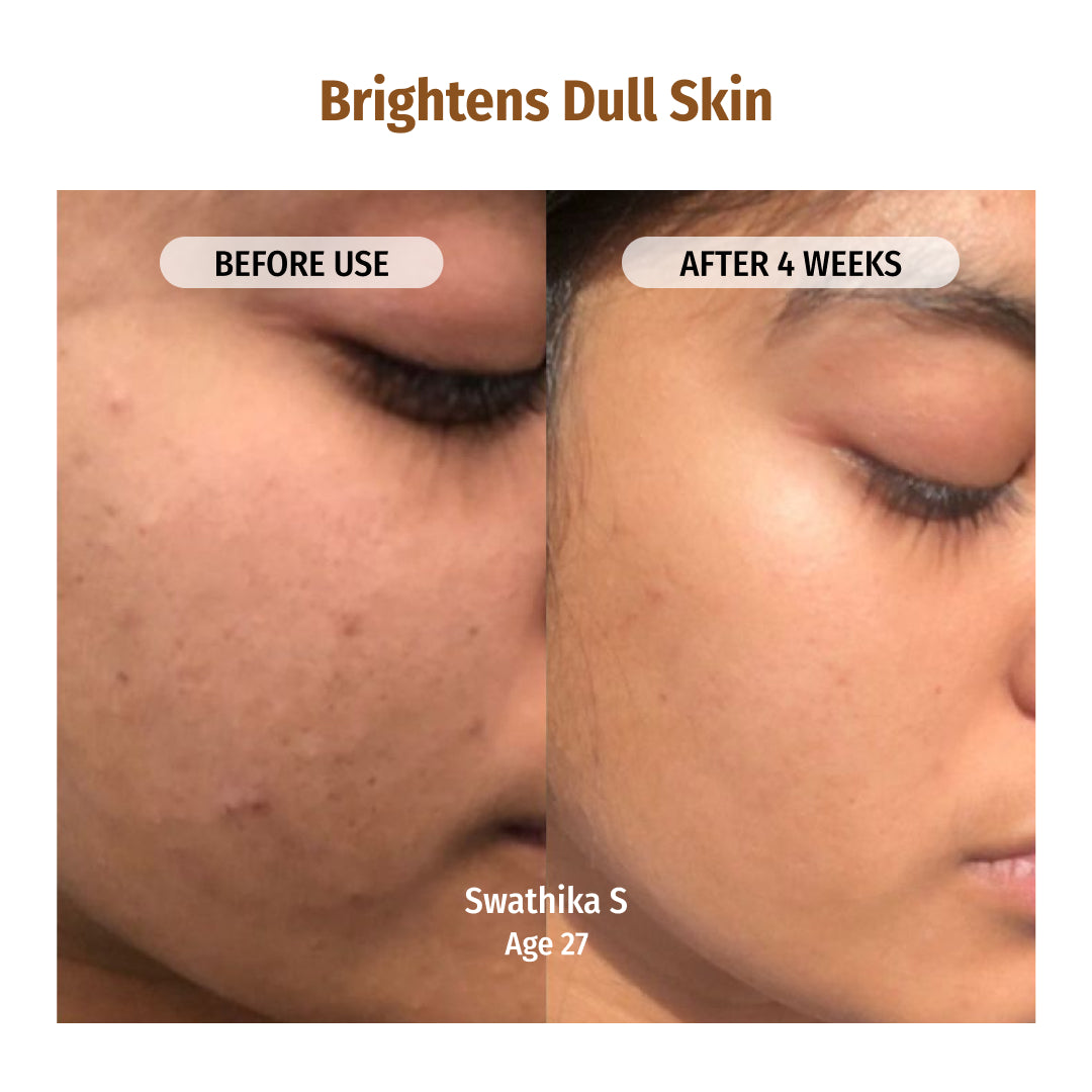 Vilvah Skin Hydration Combo Brightens Dull Skin