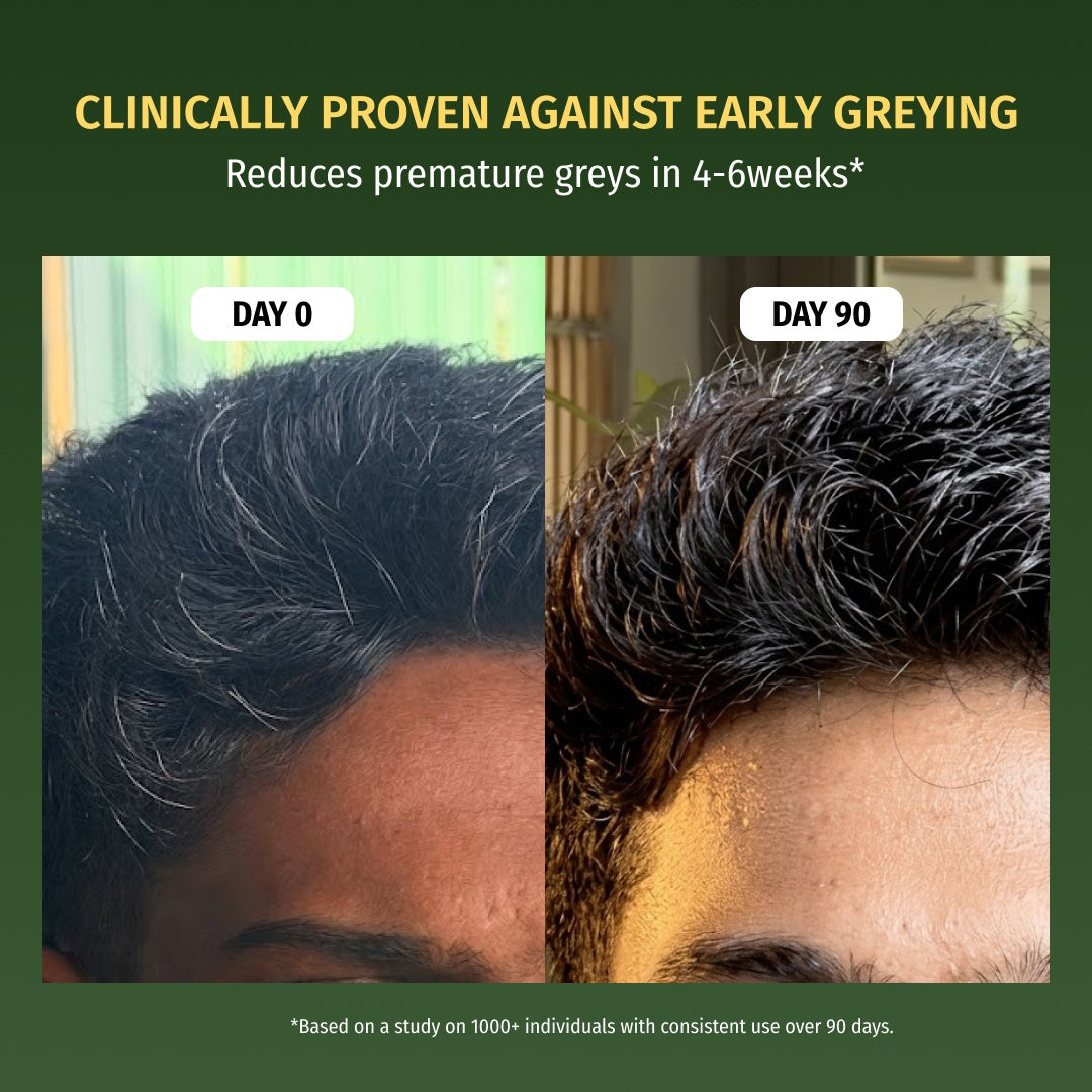 vilvah hair growth serum reduces premature greys