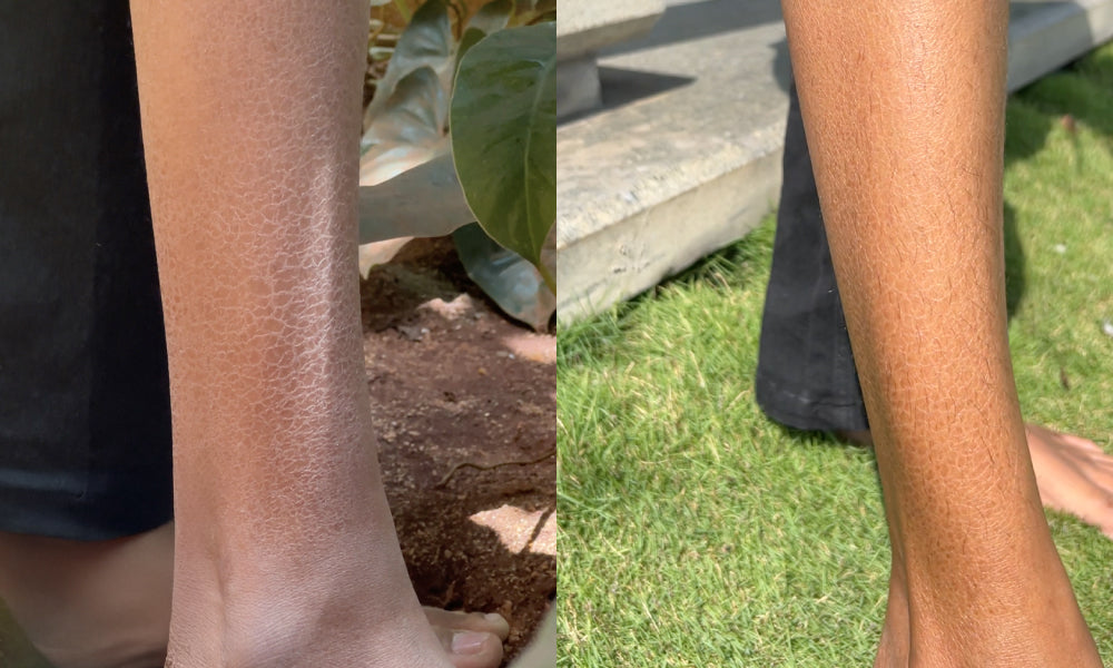 Before and after using Vilvah's milk body lotion