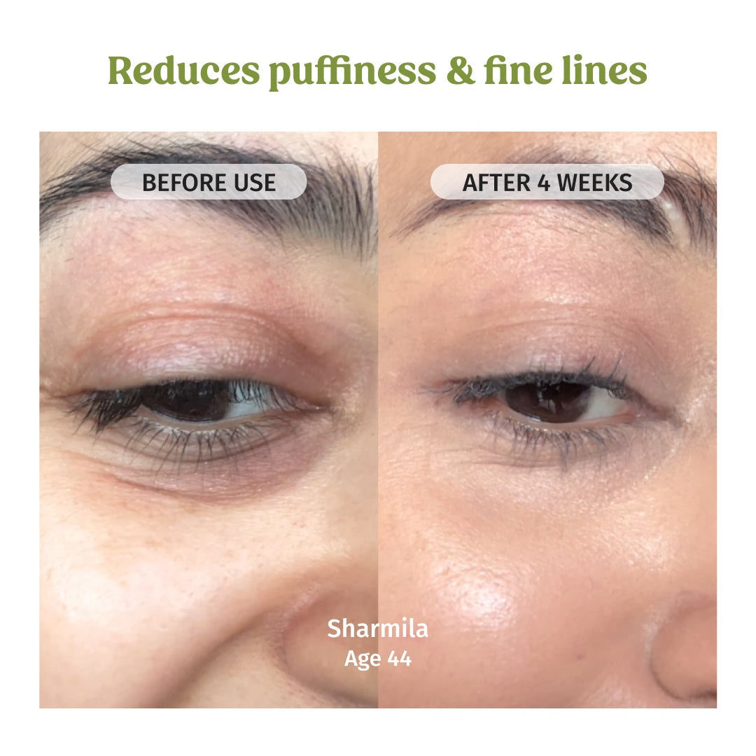 vilvah under eye cream reduces puffiness and fine lines