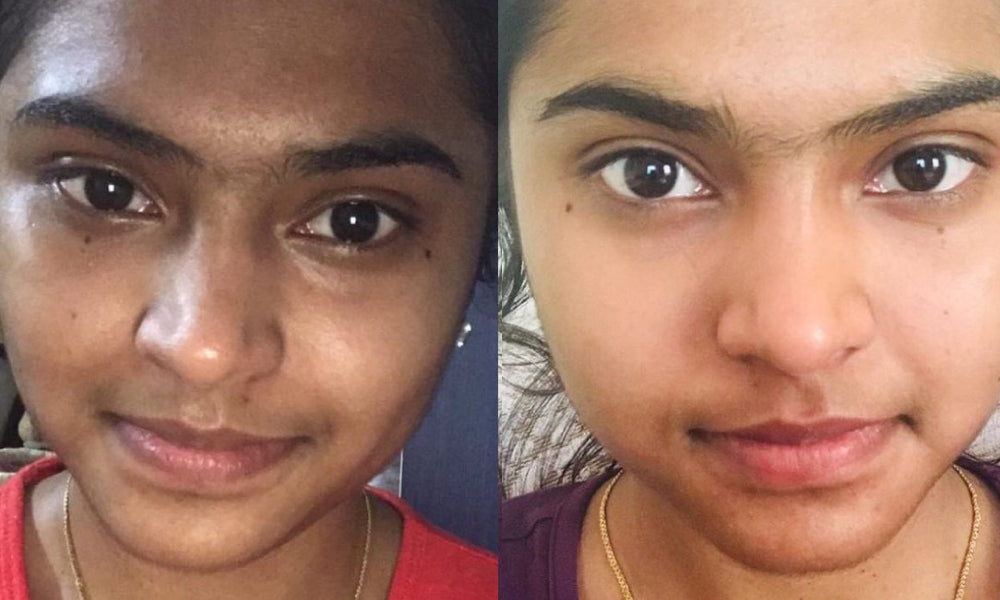 Before and after using Vilvah moringa beautifying serum