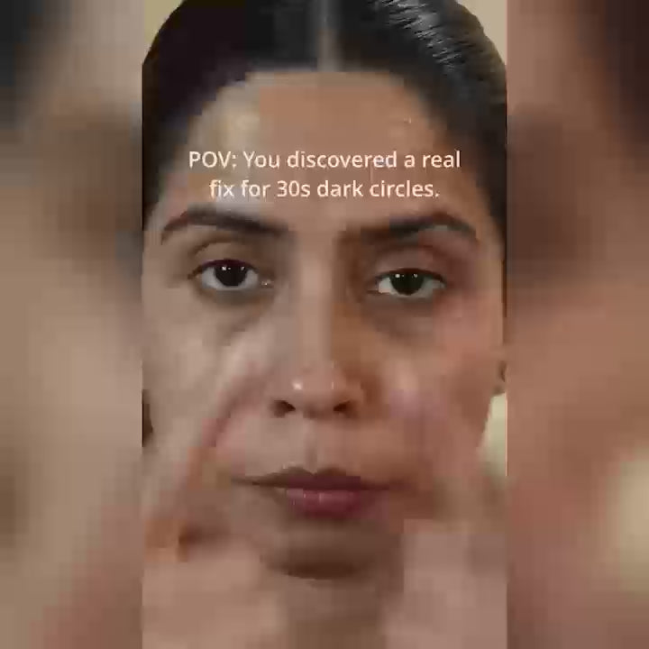 Under Eye Cream (Dark Circles Control)